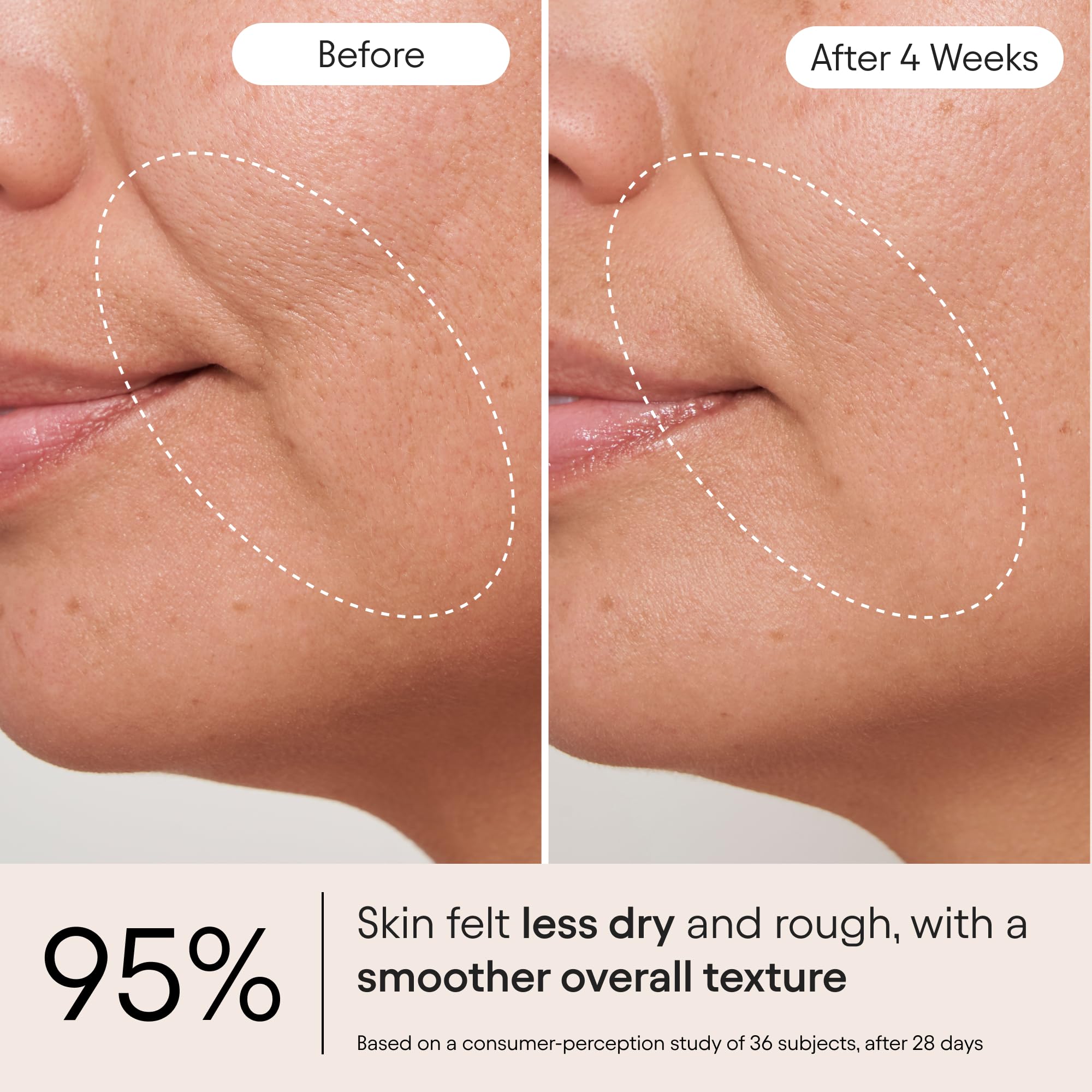 ALPYN Melt Moisturizer con ceramidas para fortalecer la barrera cutánea.