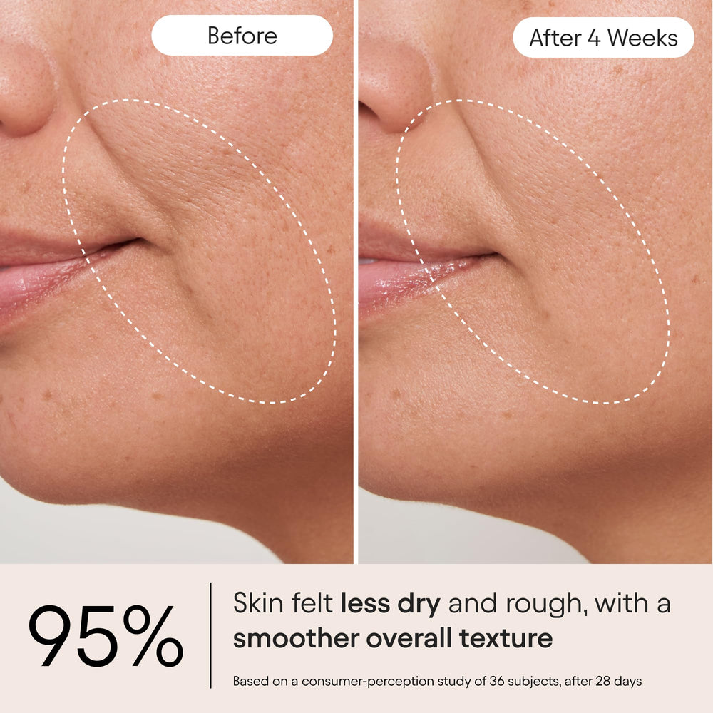 ALPYN Melt Moisturizer con ceramidas para fortalecer la barrera cutánea.