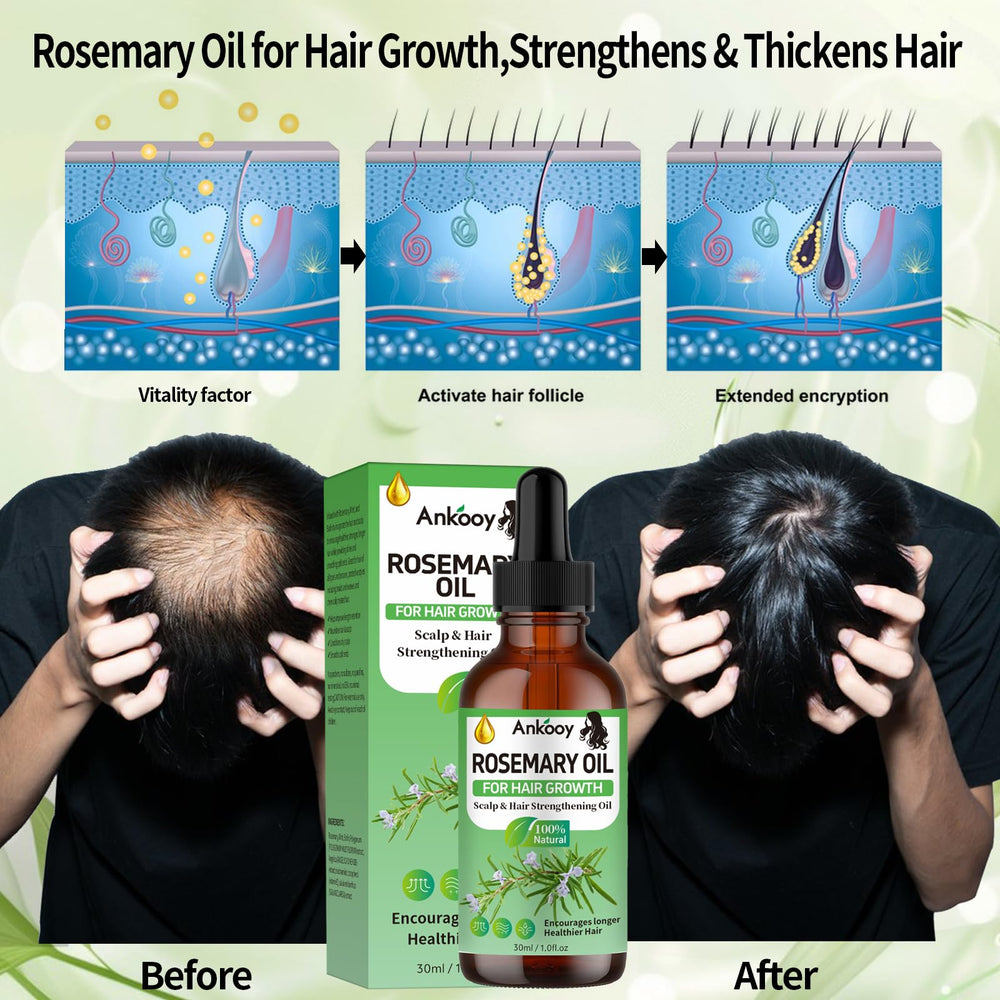 ANKOOY Aceite de Romero Cabello para cabello más grueso y fuerte.