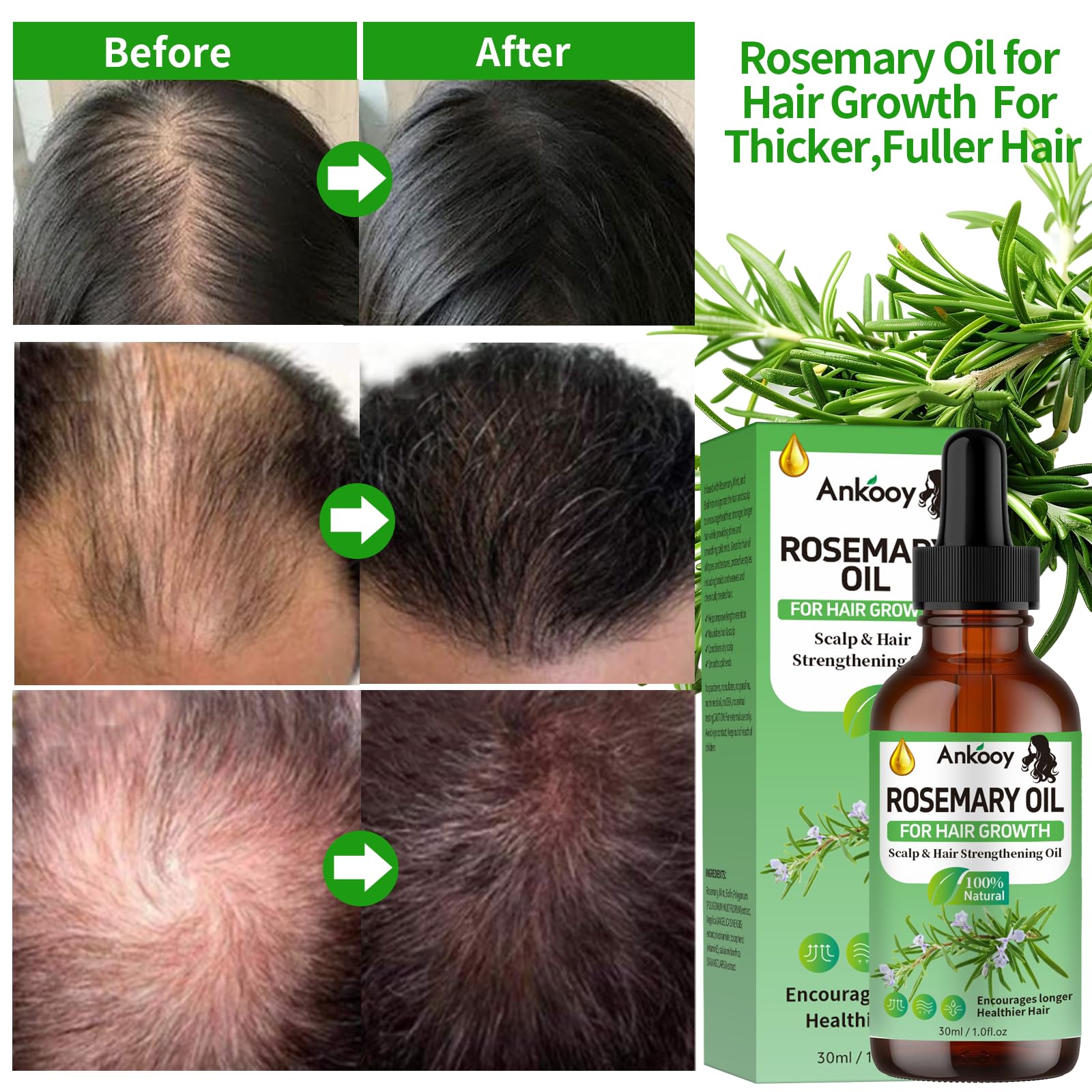ANKOOY Aceite de Romero Aplicación Manos para nutrir el cuero cabelludo.