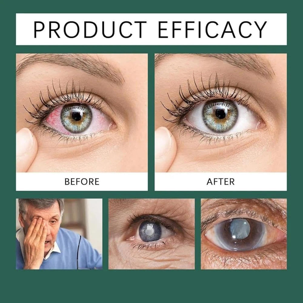 APOLO Optifusion Drops: protección con luteína para ojos expuestos a estrés oxidativo.