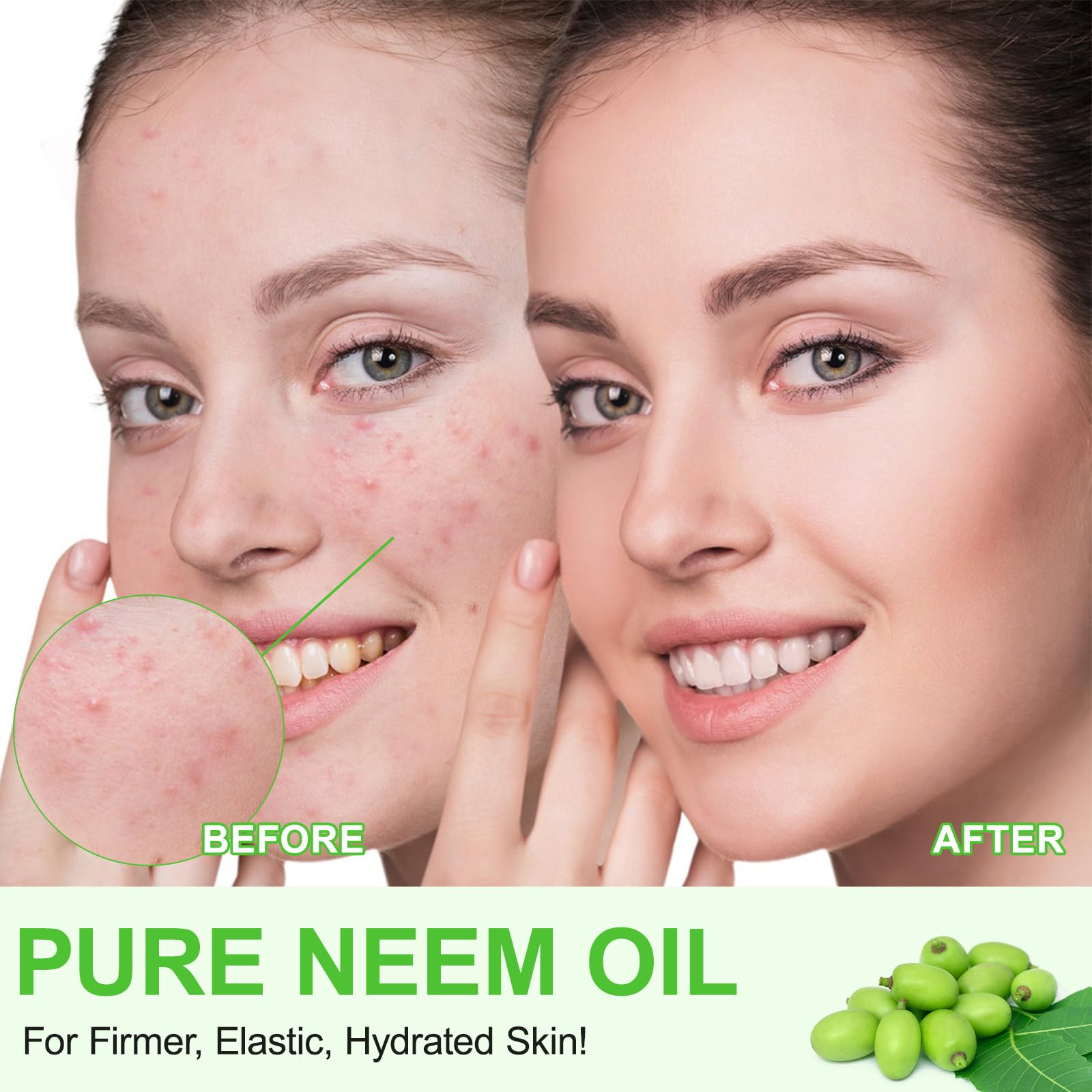 APUUFYQC Aceite Neem, uso diario para piel y cabello saludables.