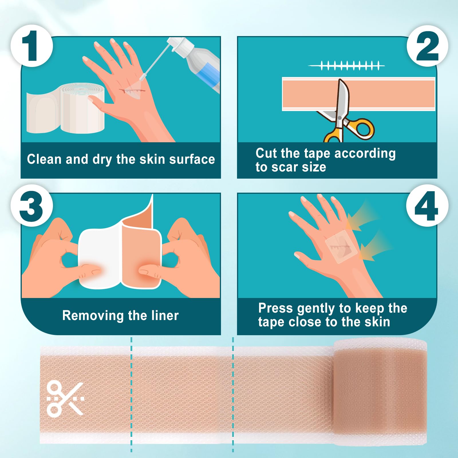 Arme Cinta de Silicona para Cicatrices, uso suave en piel sensible sin irritación