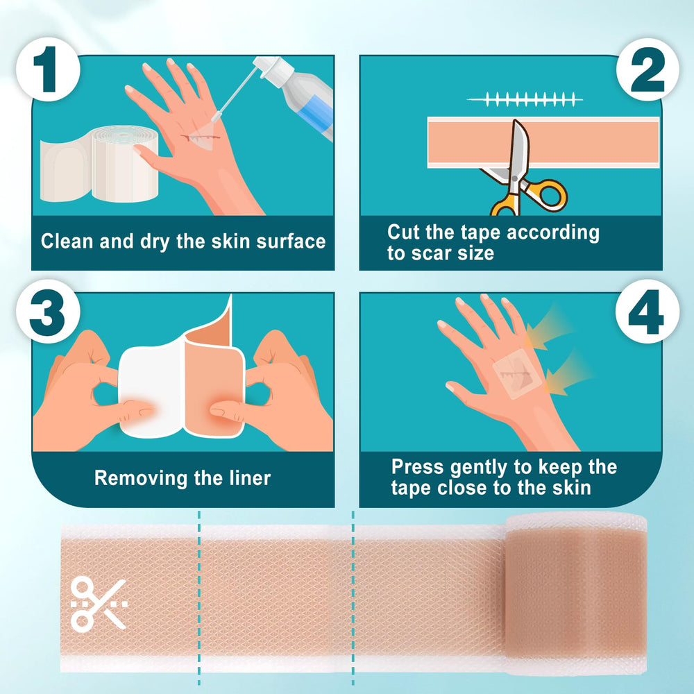 Arme Cinta de Silicona para Cicatrices, uso suave en piel sensible sin irritación