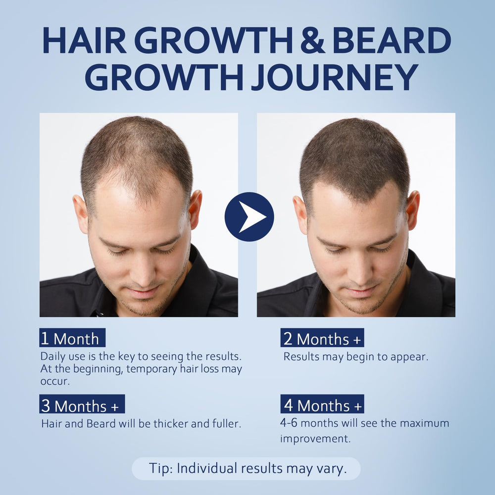 Morning and evening routine with Artimore minoxidil to support thinning hair.