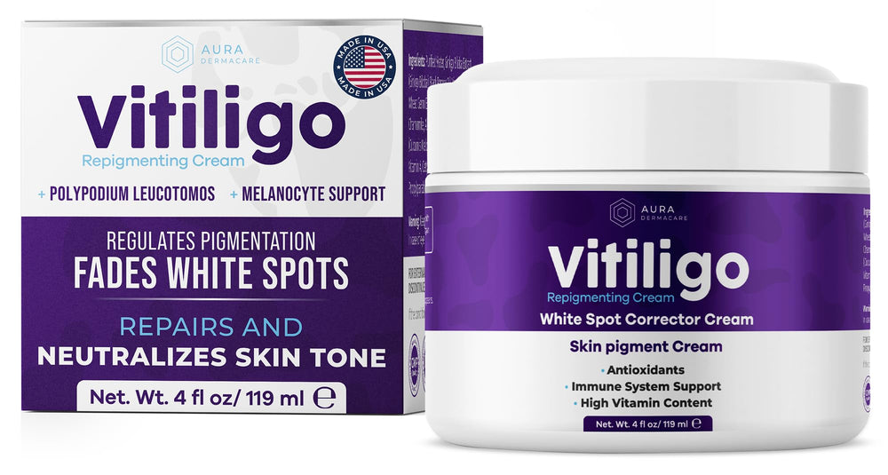 Aura Vitamins Vitiligo crema – envase 4oz para tono de piel más uniforme.
