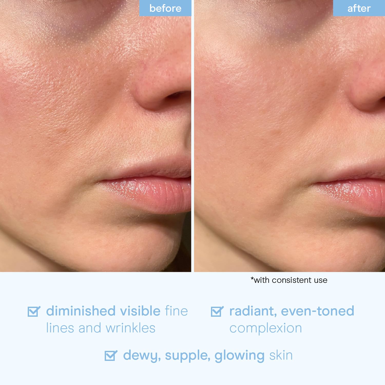 Baebody serum apto para todo tipo de piel.