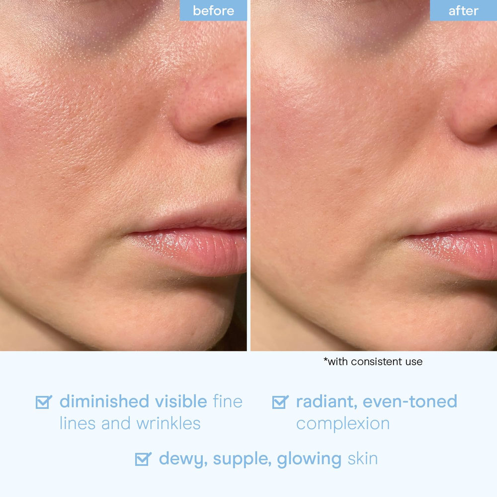 Baebody serum apto para todo tipo de piel.