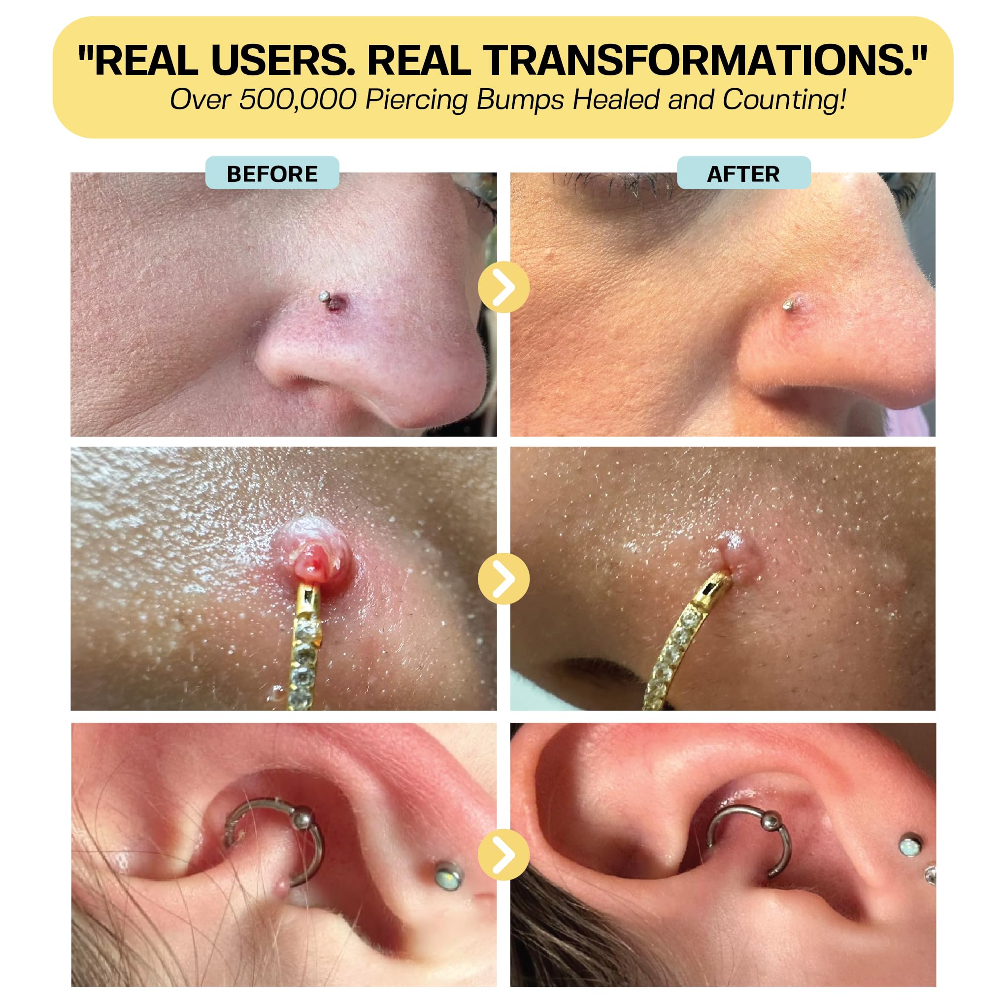 BASE LABORATORIES: cuidado natural para piercing de orejas con aplicación suave