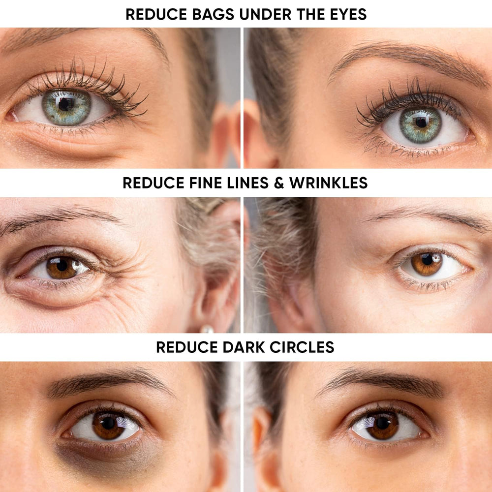 Beauty Facial Extreme: aplicación de la crema en ojos para suavizar la zona