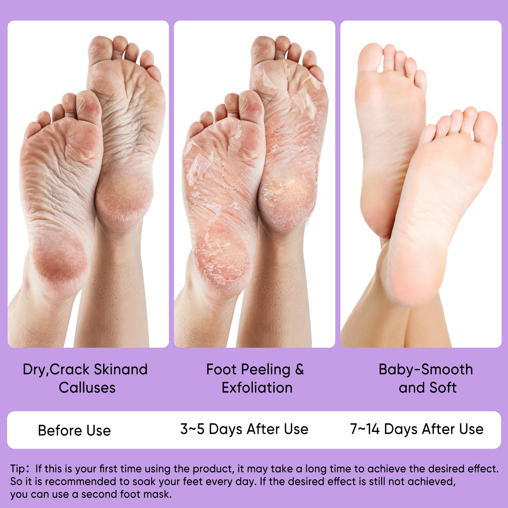 Berlaney mascarilla-pies, uso facil para pedicuria en casa