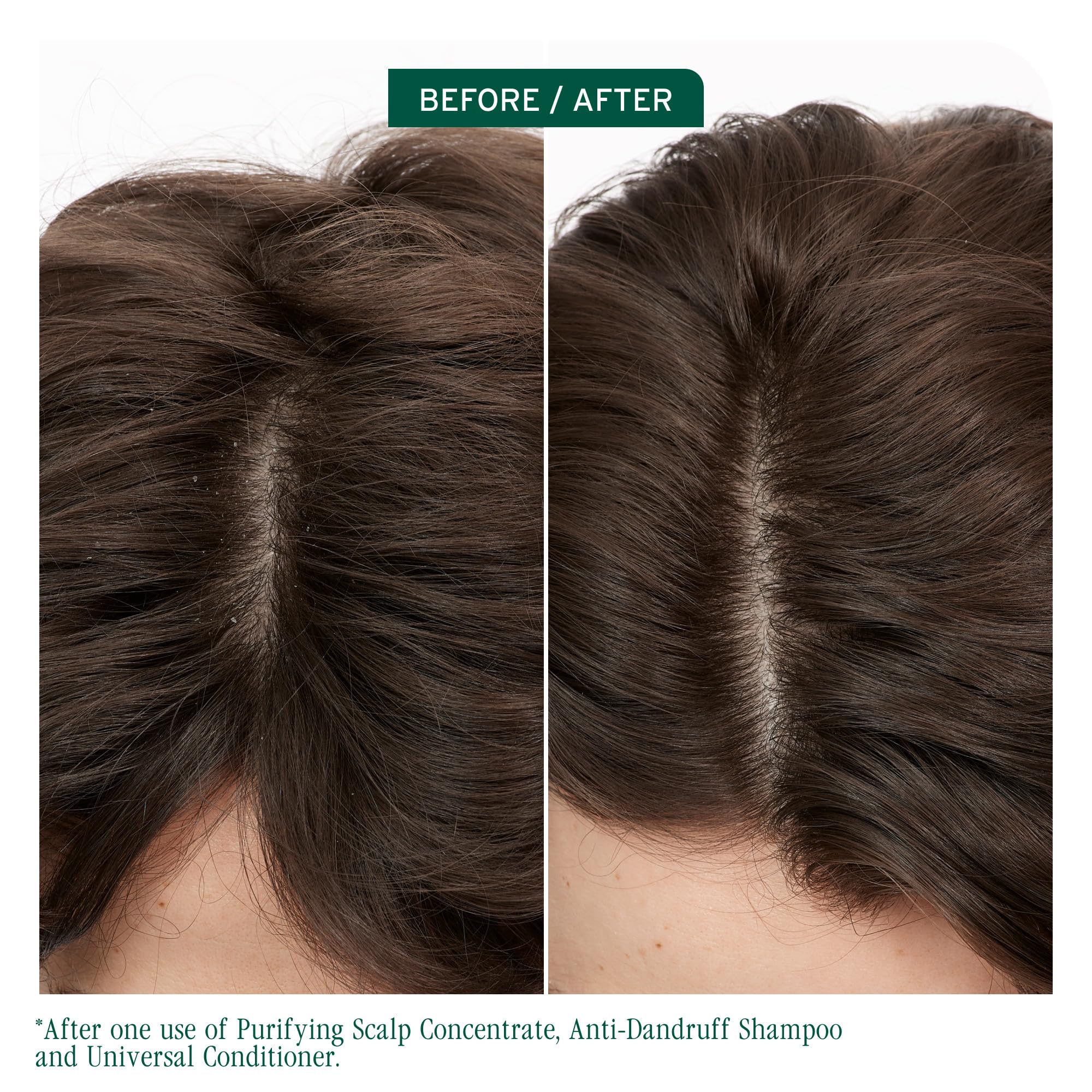 Biolage cuero cabelludo sincronizacion champú anticaspa, vertido suave sobre el cabello.