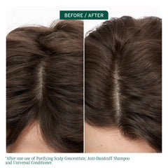 Biolage cuero cabelludo sincronizacion champú anticaspa, vertido suave sobre el cabello.