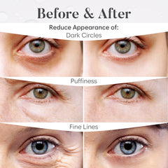 Bloomora parches ojos rosa: ingredientes iluminadores para una mirada más luminosa.