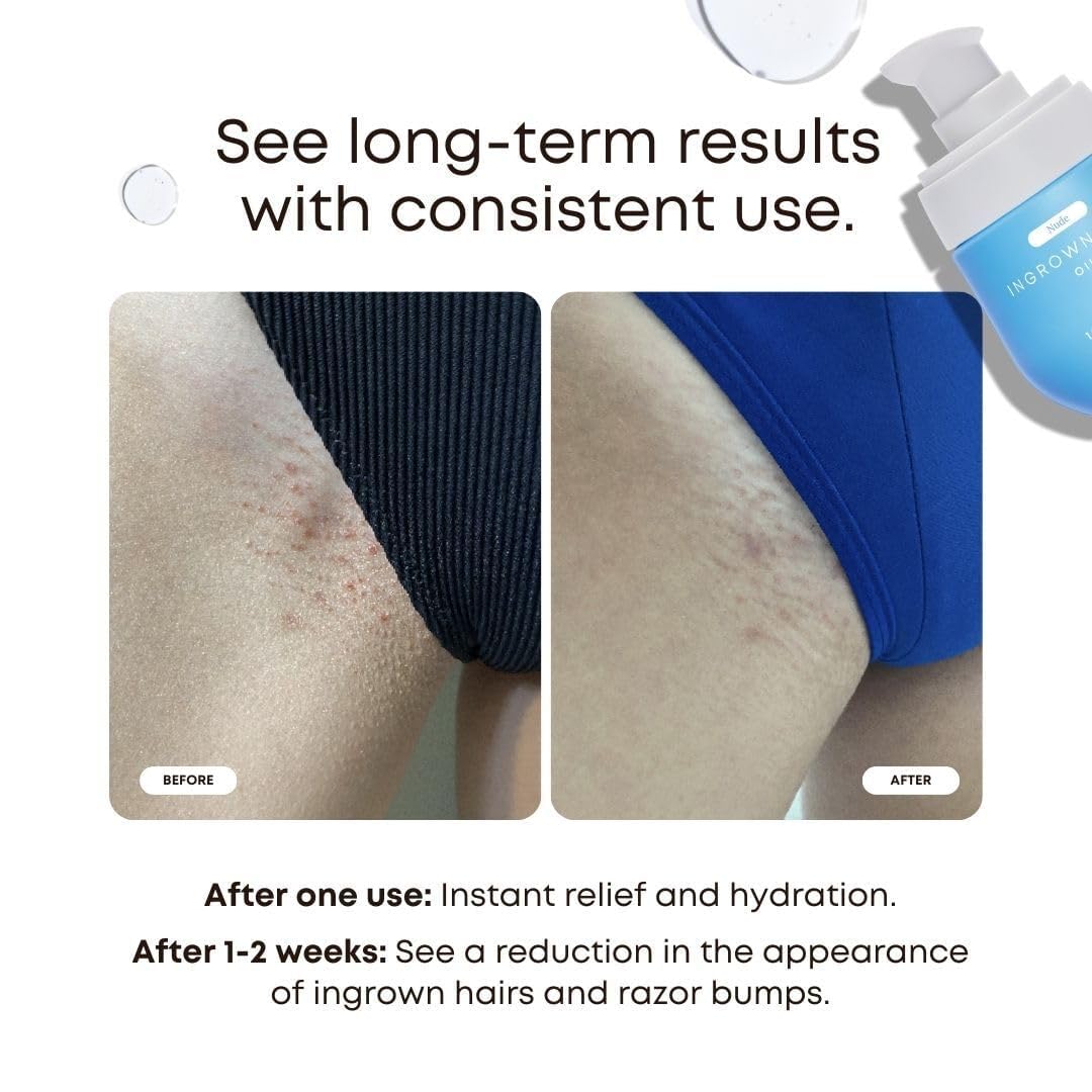 Aplicación de Nude Oil en piel para calma y alivio suave.