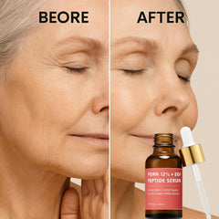 CELDYQUE Serum hidratación profunda con ácido hialurónico y ceramidas para la piel.