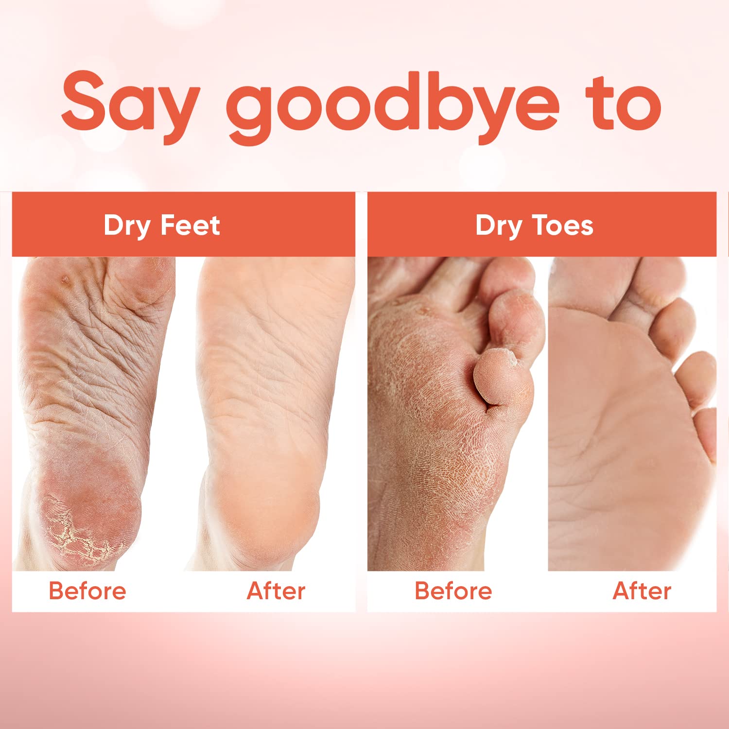 CÉLOR Foot Peel Mask apta para hombres y mujeres, talla universal.