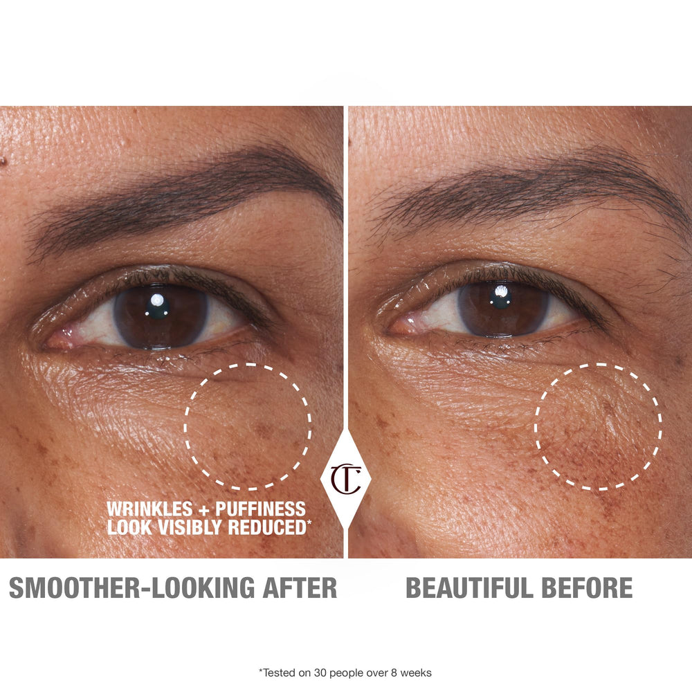 Aplicación Cryo-Recovery para ojos, masaje suave deshincha la zona