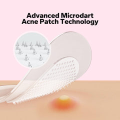 CharmCherry parche acné para tono de piel, adherencia duradera y discreta