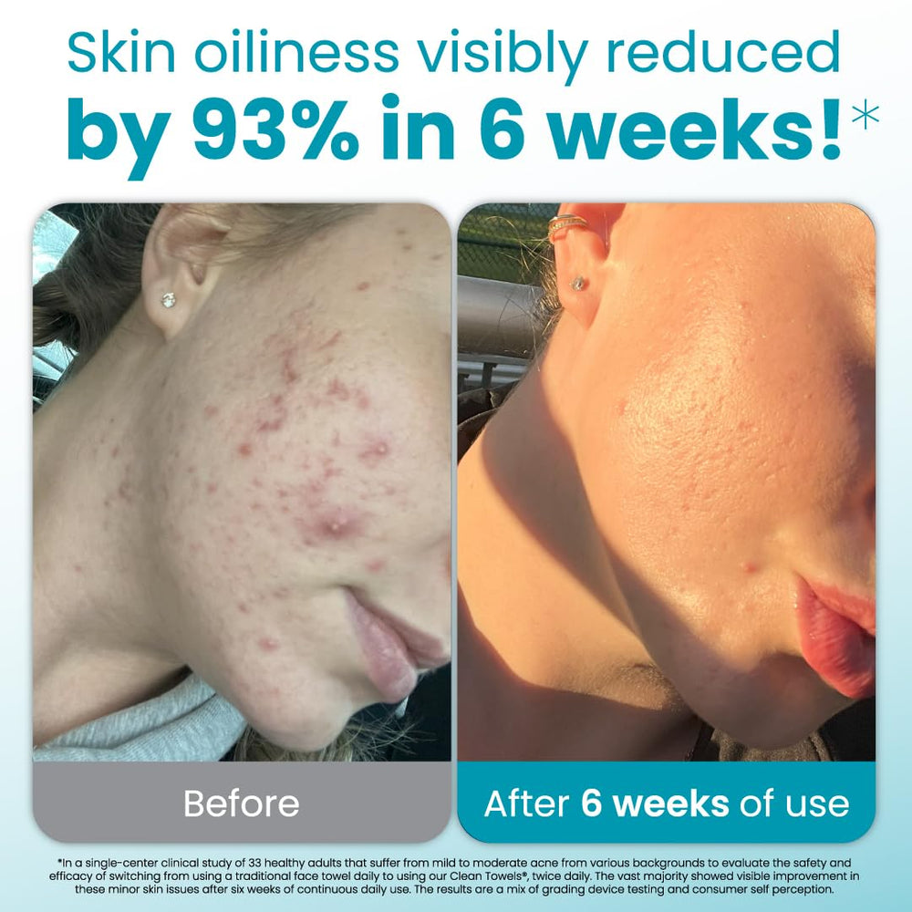 Toallas faciales desechables Clean Skin Club para uso individual, tamaño XL