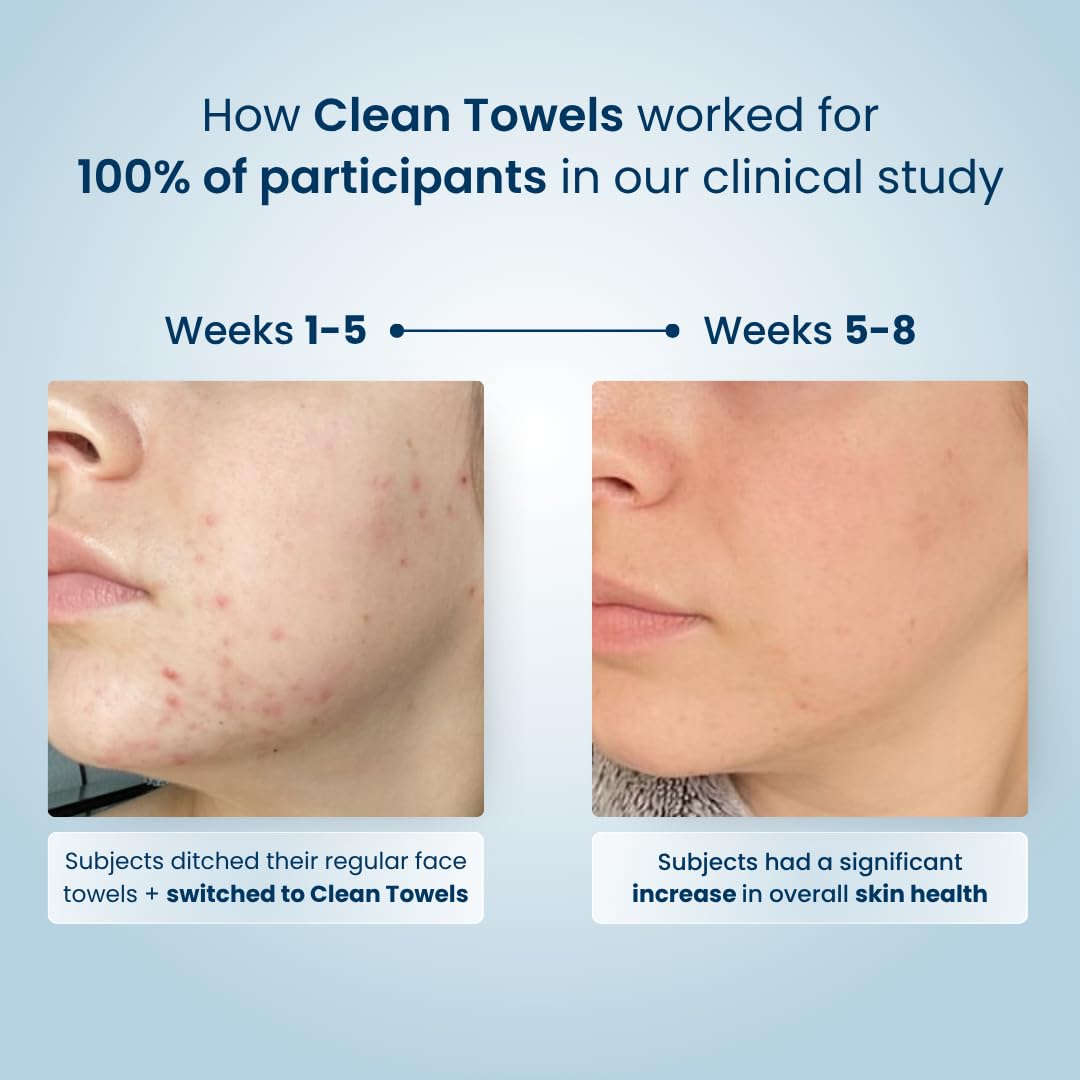Clean Skin Club - toallas faciales hipoalergicas para cuidado diario