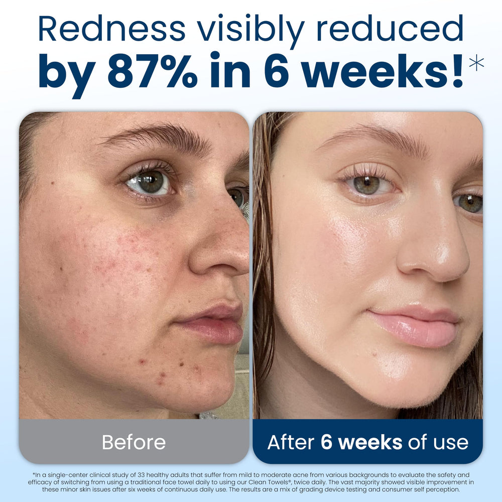 CLEAN SKIN CLUB paquete viaje XL para cuidado facial en ruta.