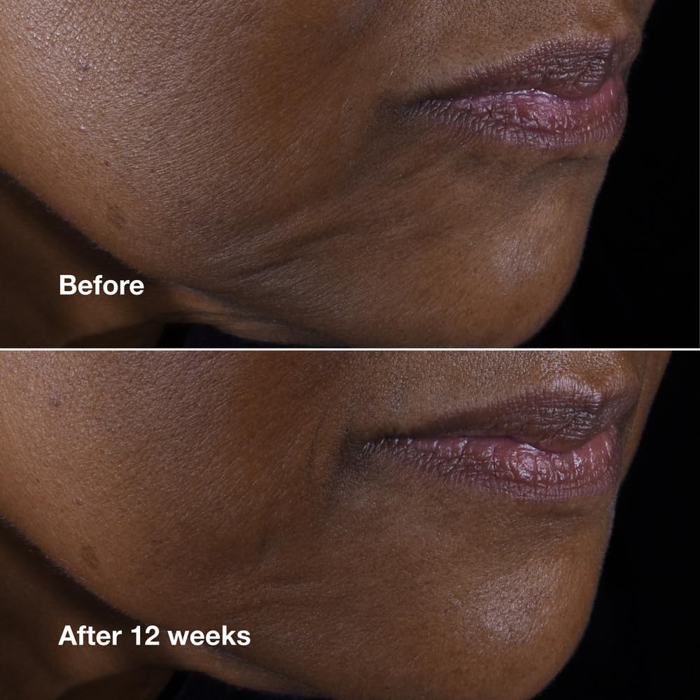 Clinique Smart Clinical Repair, aplicación suave en rostro para un tono uniforme.