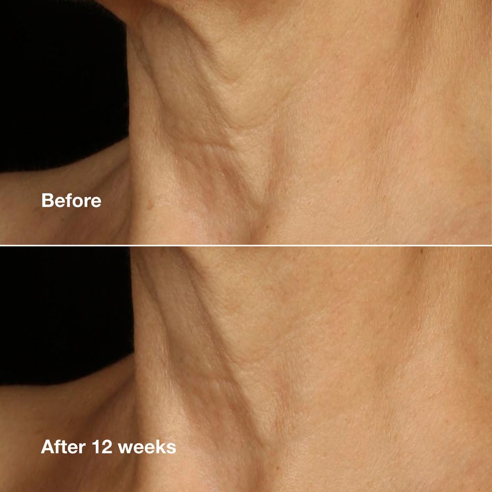Clinique Smart Clinical Repair probado dermatológicamente; apto para piel sensible sin fragancia.