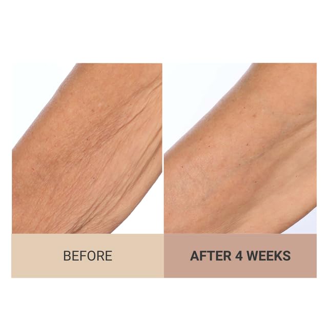 Consult Beaute Champagne Lift piel más hidratada y suave tras uso diario.