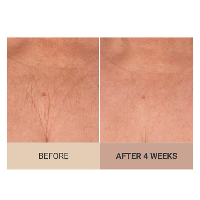 Consult Beaute Champagne Lift masaje en piernas y brazos para suavidad.