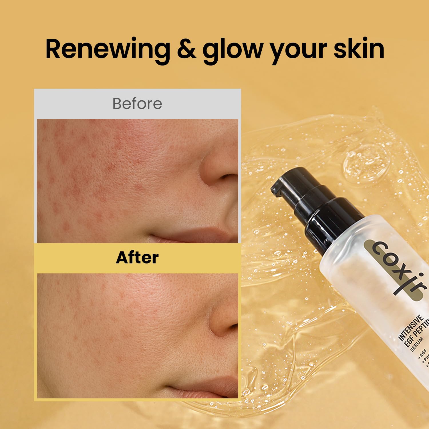 Coxir Intensivo EGF Peptidos Serum, pipeta, aplicación precisa para el rostro