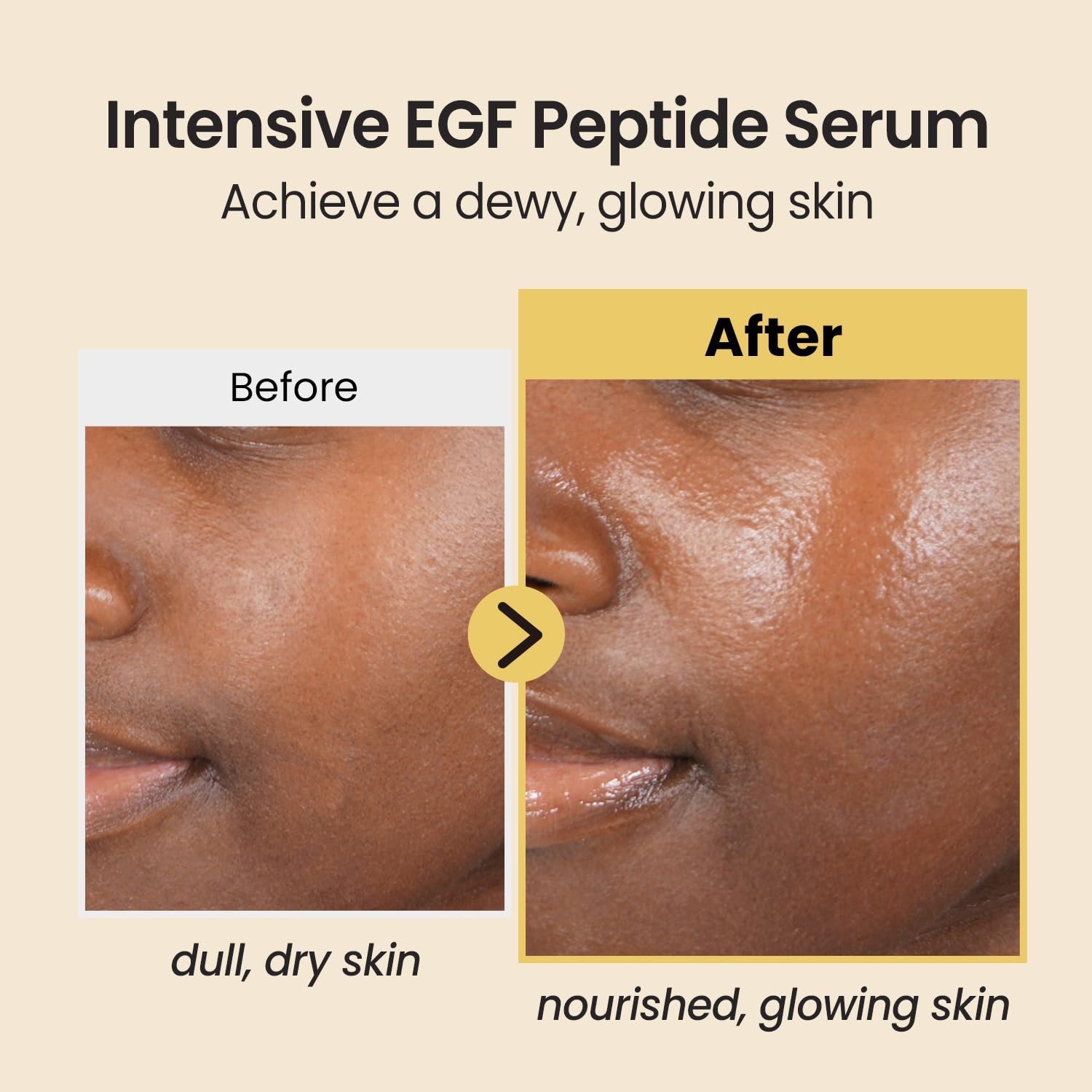 Coxir Intensivo EGF Peptidos Serum, textura ligera para absorcion rapida