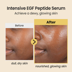 Coxir Intensivo EGF Peptidos Serum, textura ligera para absorcion rapida