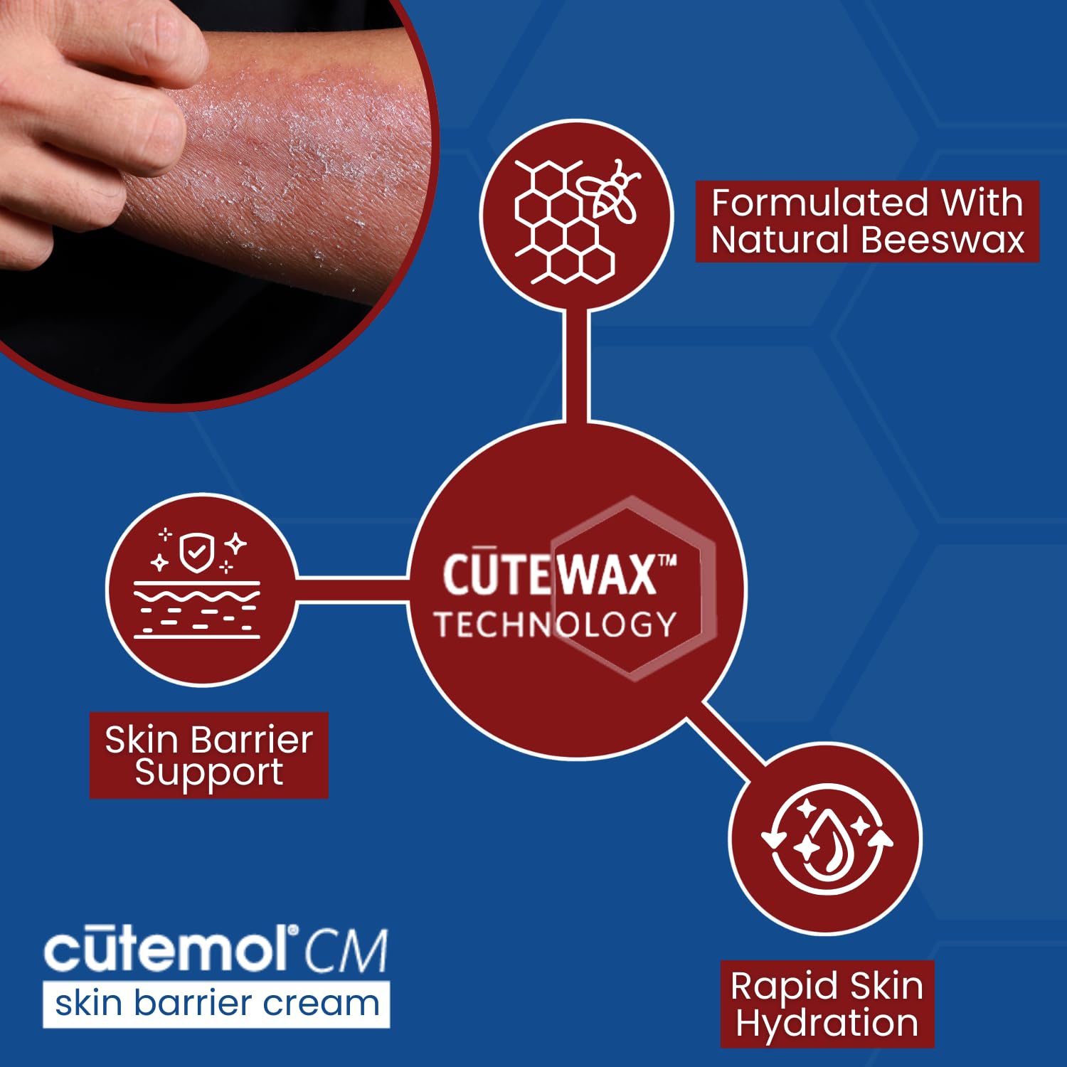 Cutemol CM crema emoliente ceramidas y cera de abeja protegen la piel