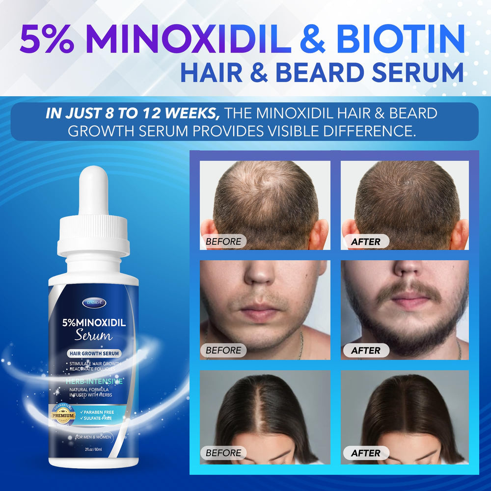Gotero de DABIDA Minoxidil para aplicación precisa en el cuero cabelludo.