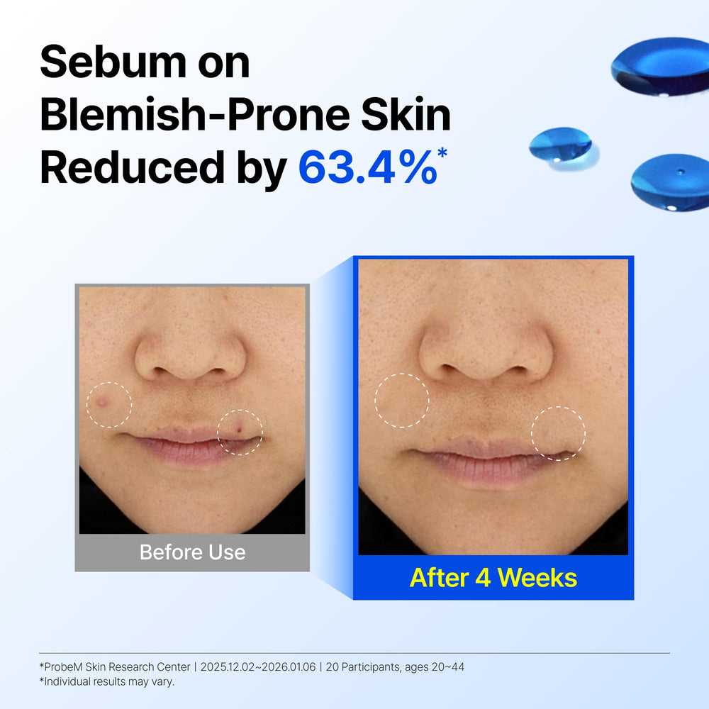DearKlairs EGF serum para piel sensible, ayuda a calmar molestias y rojeces.