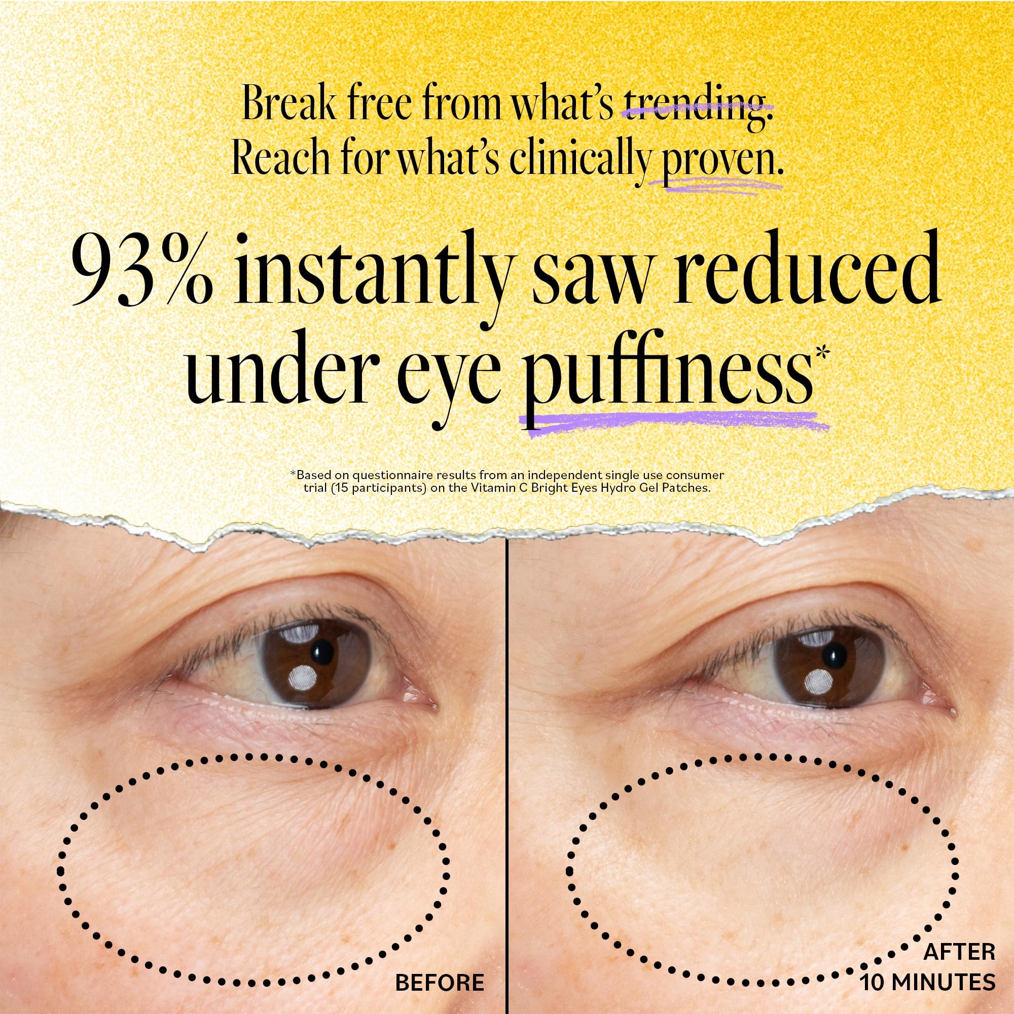 Derma E parches ojos vitamina C y B3 iluminan rostro cansado.