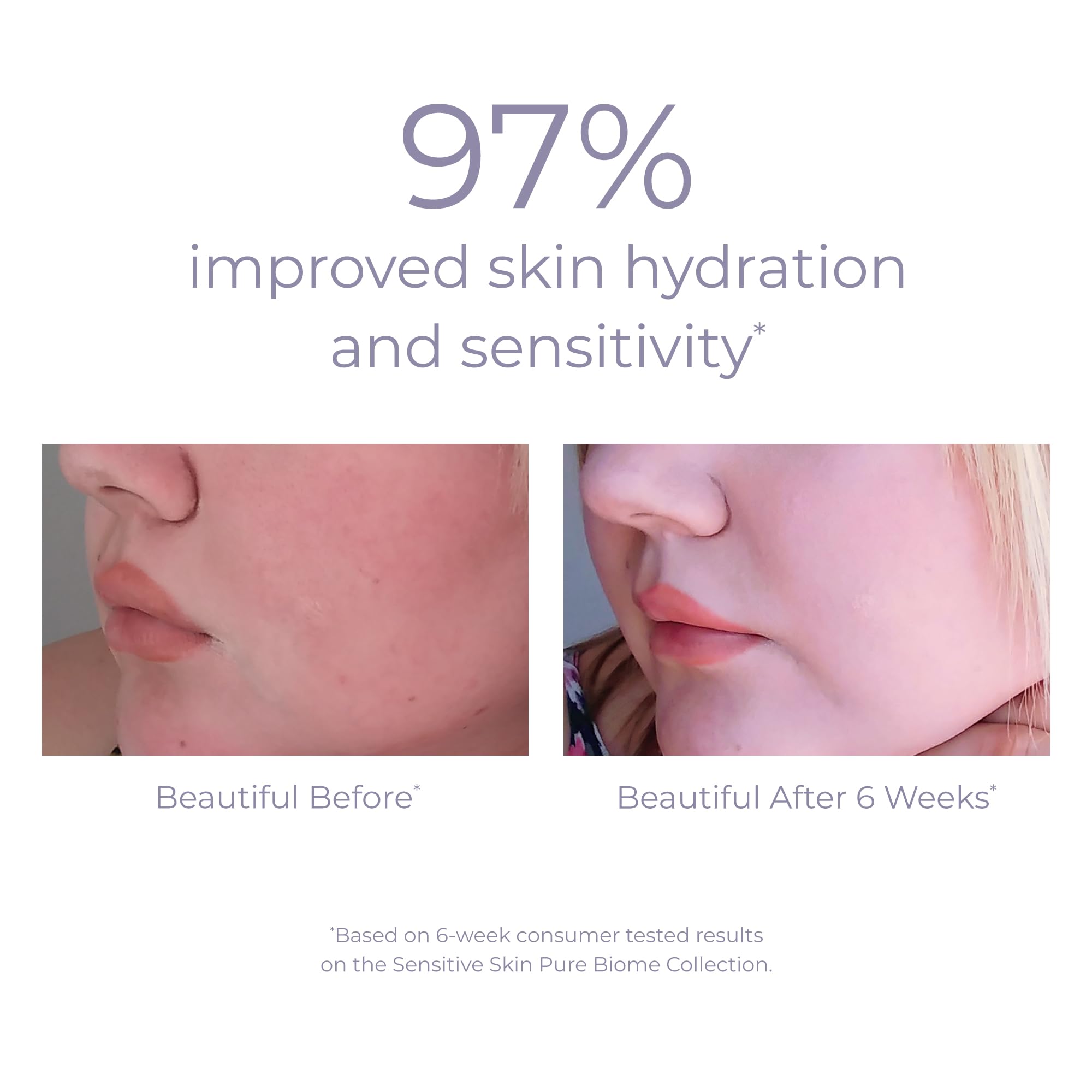 DERMA E Pure Biome Balancing Serum, niacinamida para mantener la humedad.