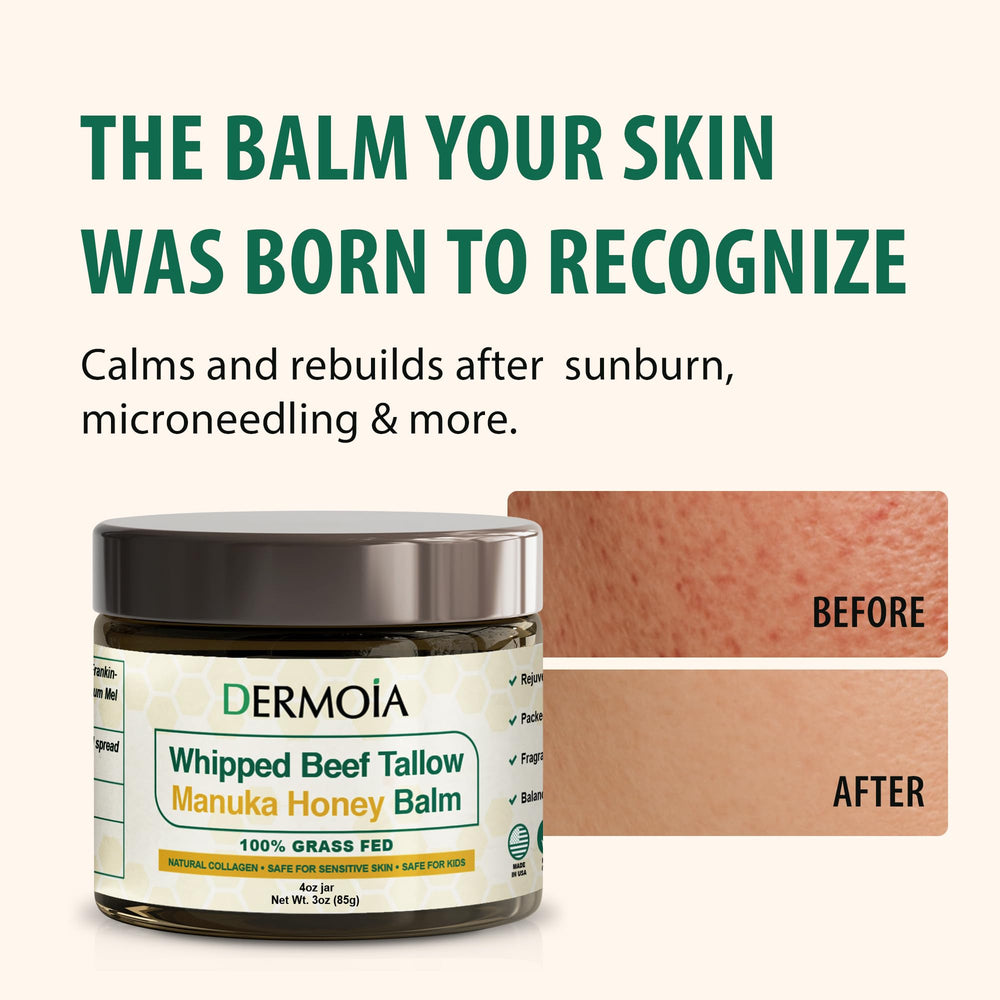 DERMOIA hidratante facial y corporal para piel seca y sensible.