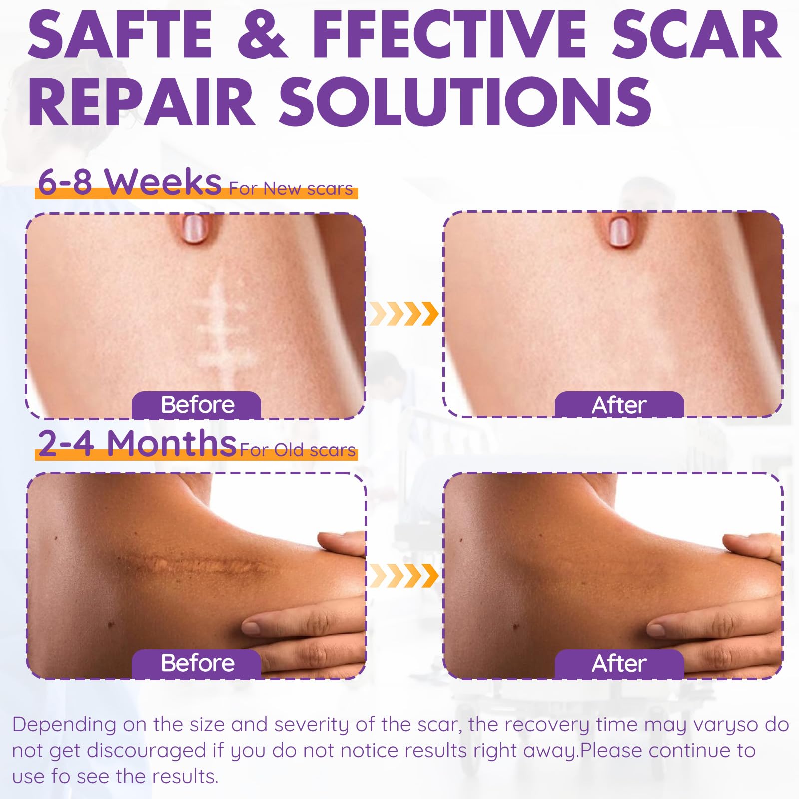 DfK hojas silicona cicatriz acne: ayuda a mantener hidratada la piel mientras se suavizan las marcas.