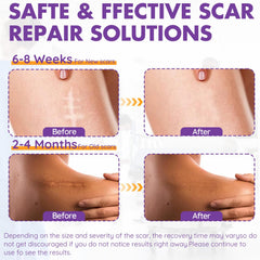 DfK hojas silicona cicatriz acne: ayuda a mantener hidratada la piel mientras se suavizan las marcas.