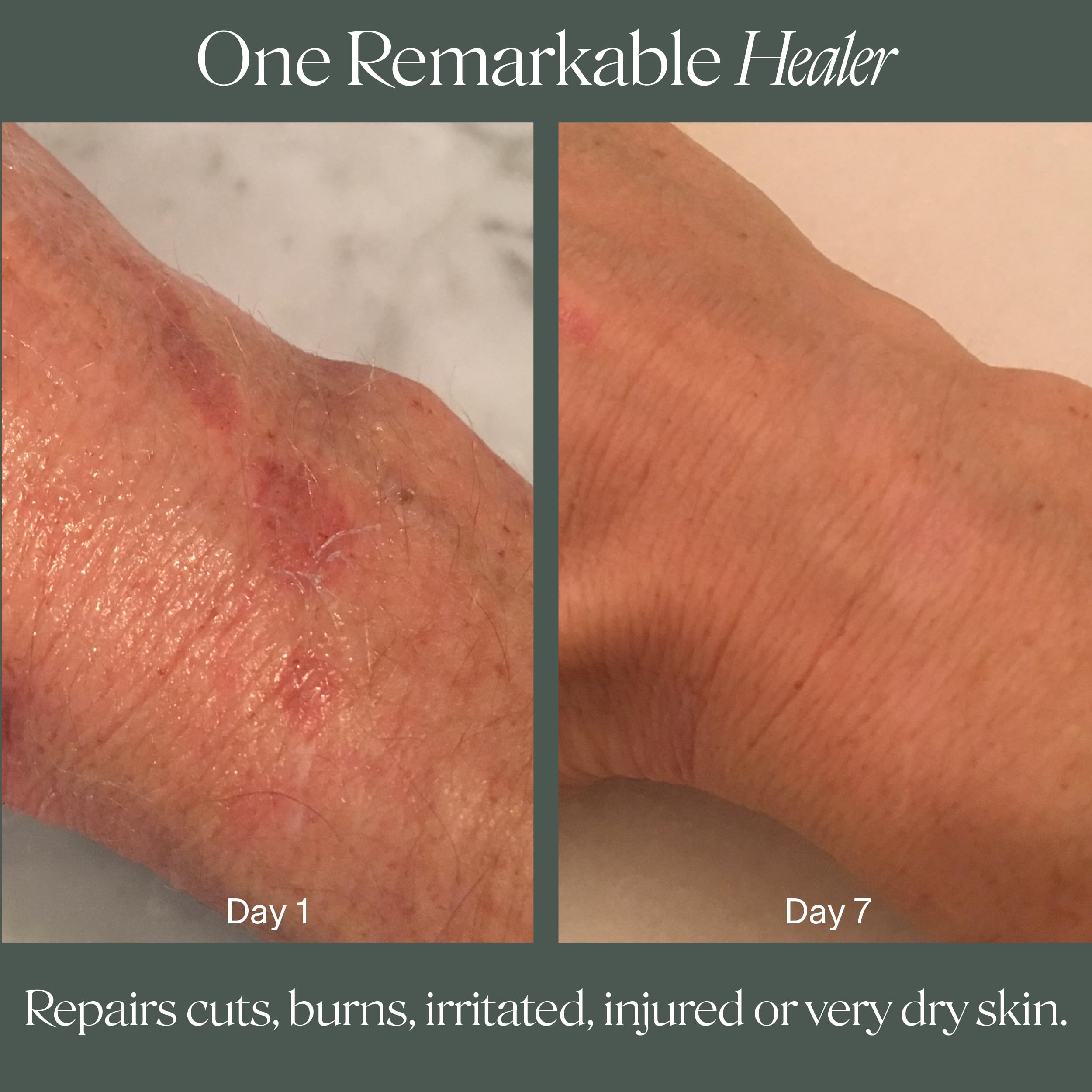 Piel sensible se beneficia con Doctor Rogers Restore gracias a su formulación vegana.