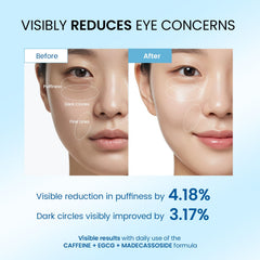 Dongyu cafeína para ojos, energía matutina y reducción de hinchazón.