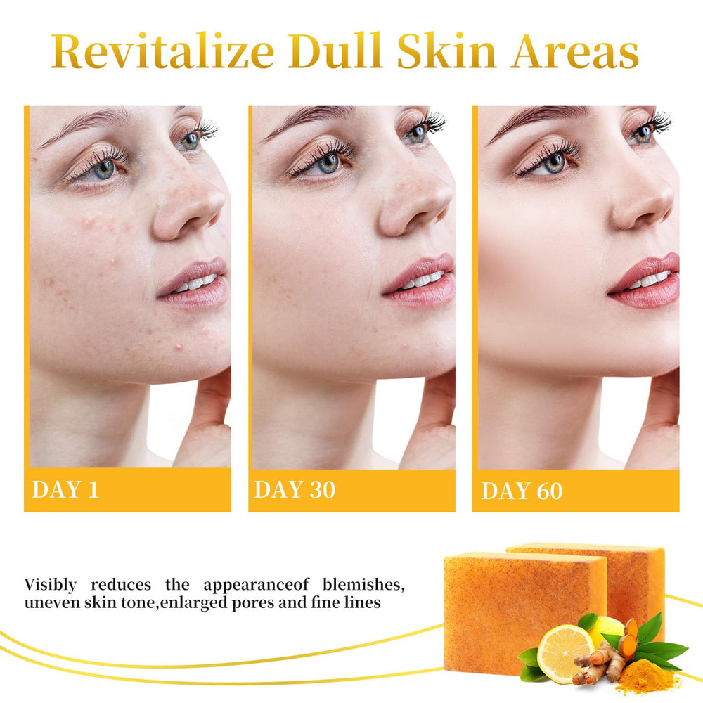 DOXOLATO barra exfoliante limón curcuma para cuerpo, textura revitalizada