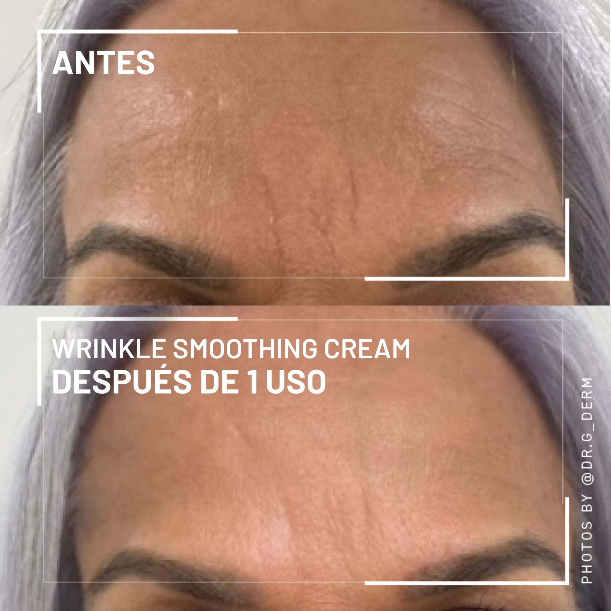 Dr. Brandt crema alisadora de arrugas con ceño menos marcado para descansar