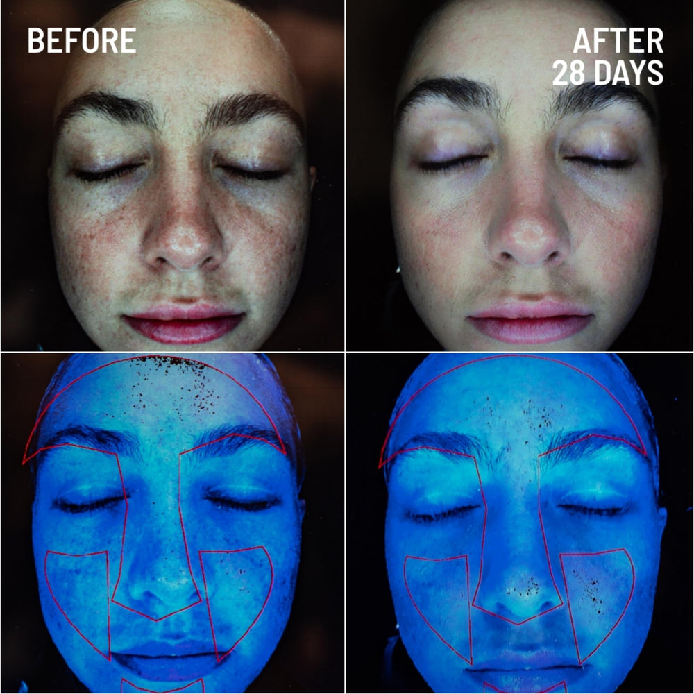 Dr Brandt Microdermabrasion, granulos biocelulosa para exfoliación segura