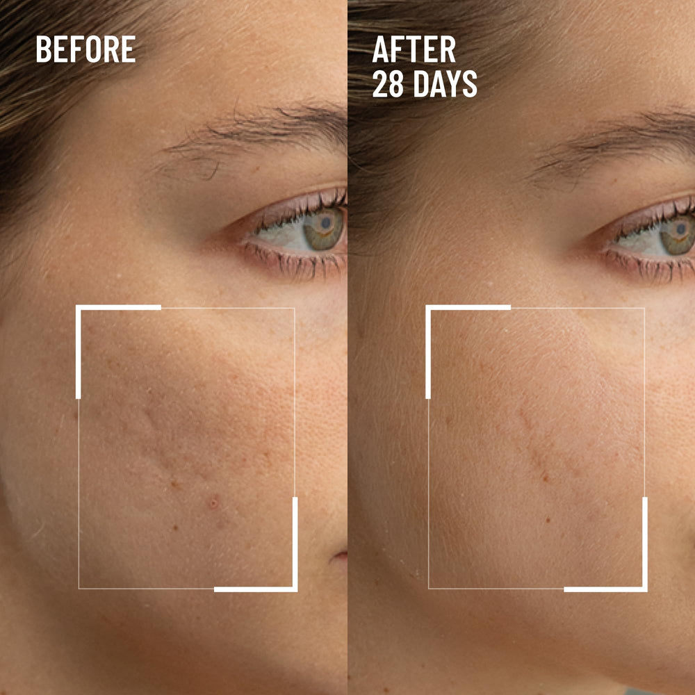Dr Brandt Microdermabrasion, pulido suave para una piel más lisa