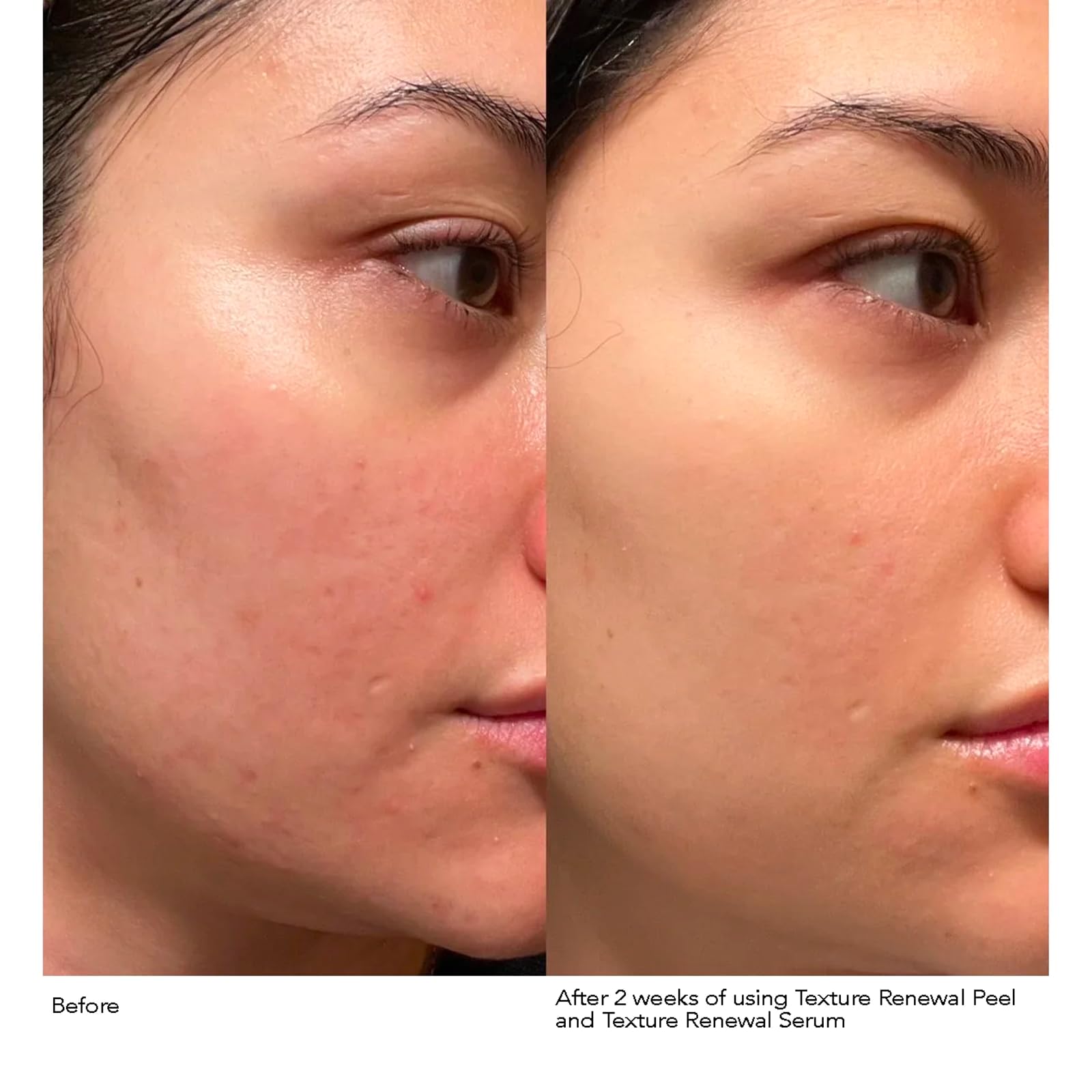 Dr Dennis Gross Advanced Retinol + Ferulic Serum, ingrediente-retinol presente para beneficio potencial.