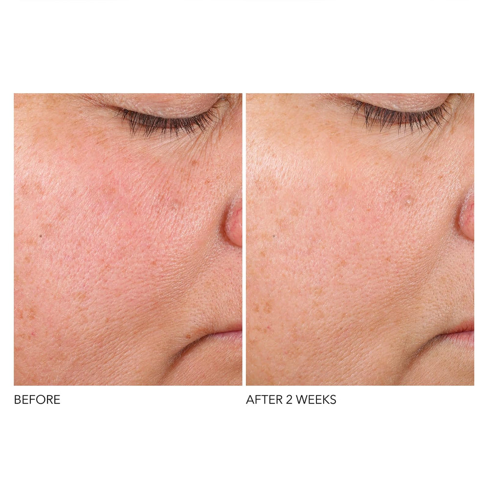 Dr Dennis Gross Advanced Retinol + Ferulic Serum, uso-manual explica paso-a-paso.