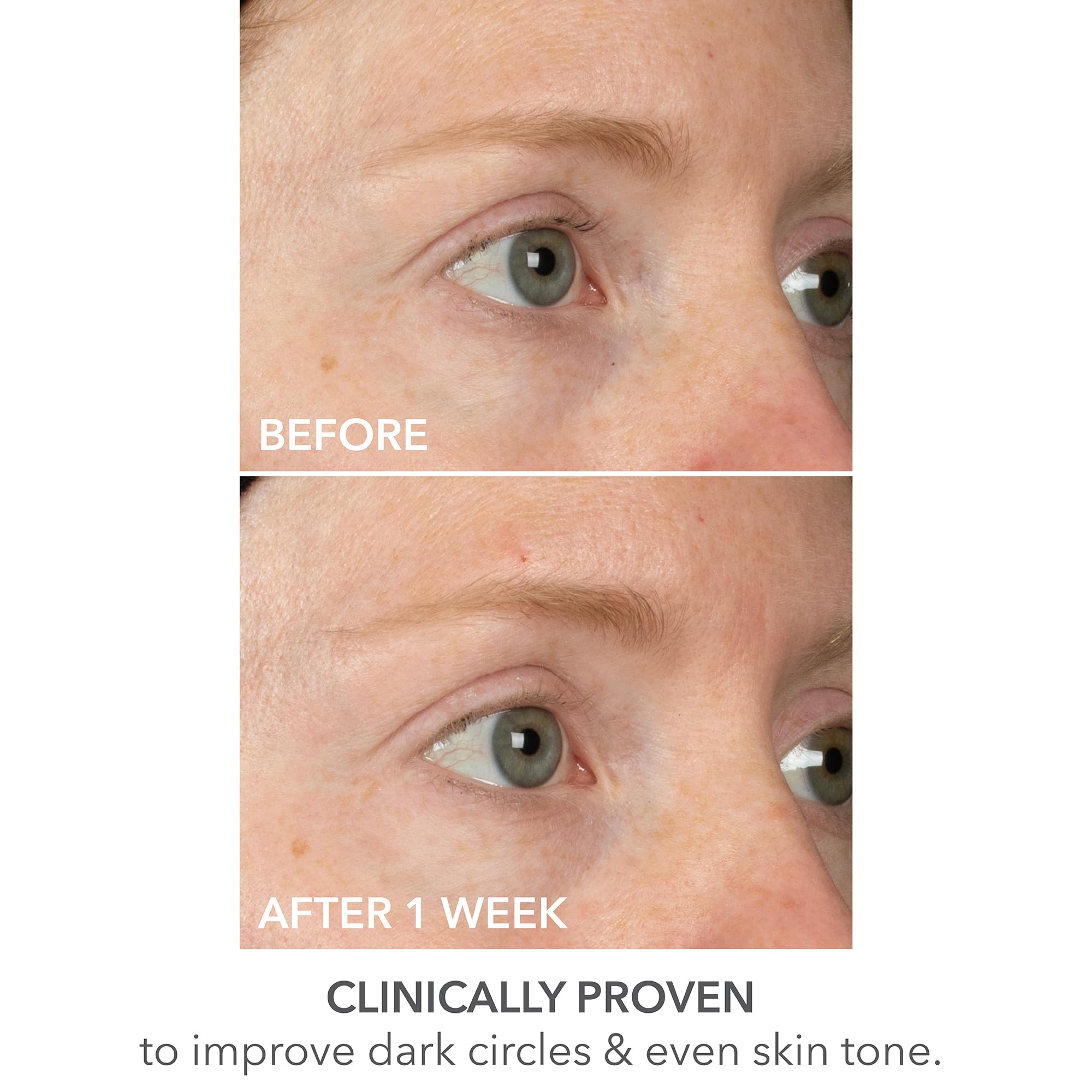 DermInfusions Lift + Repair Mascarilla para Ojos de Dr Dennis Gross: uso cómodo en casa para cuidado diario